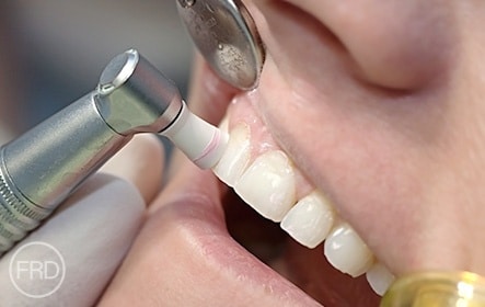 dental hygienist appointment cost