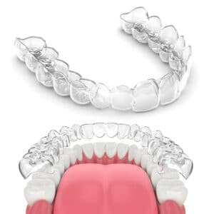 FRD-Invisalign-Model
