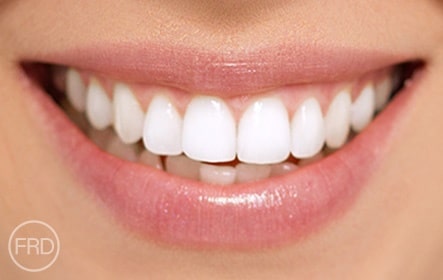 teeth whitening dentist
