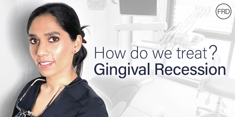 Treating Gingival Recession at Fulham Road Dental