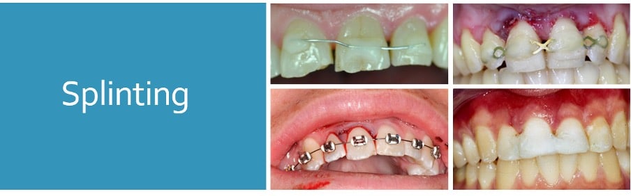 Luxation Splinting