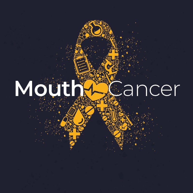 mouth cancer screening