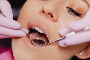 is a private dentist worth it?