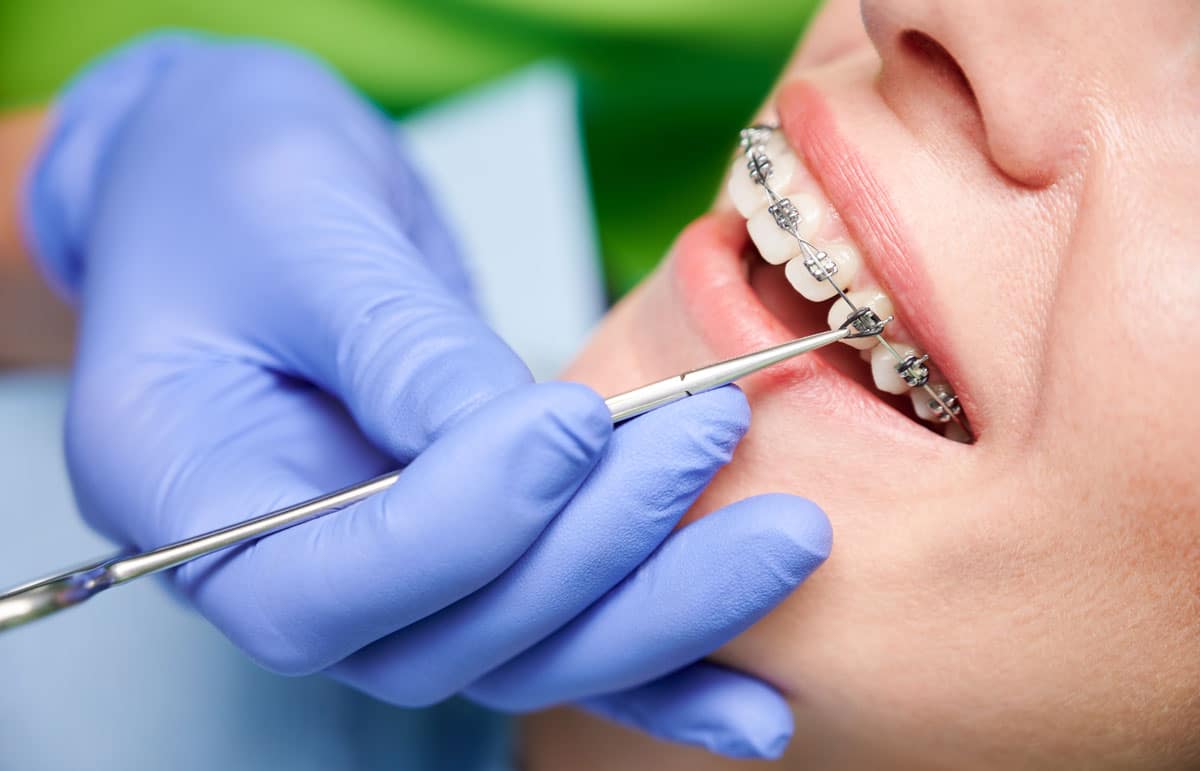Orthodontics - Child having their braces tweaked 