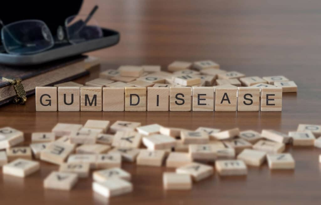 Understanding gum diseases