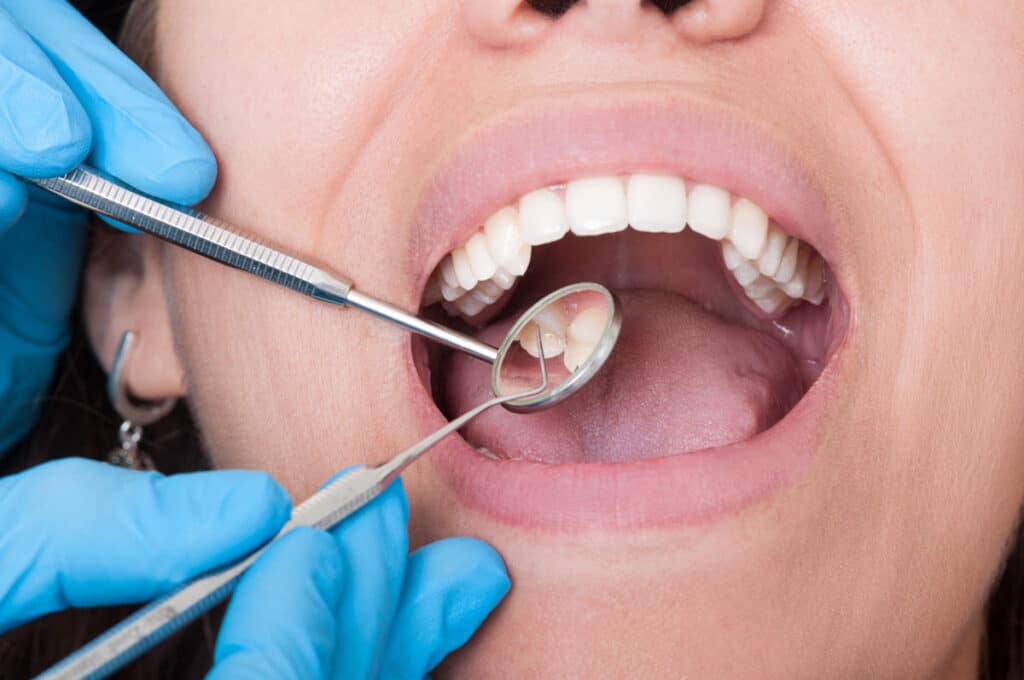 When to see a dentist