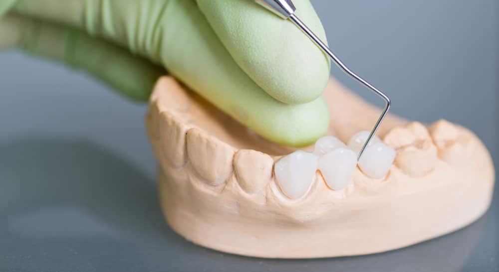 materials used for dental crowns