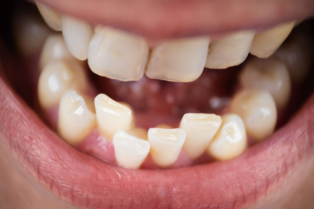 How to choose the best orthodontist