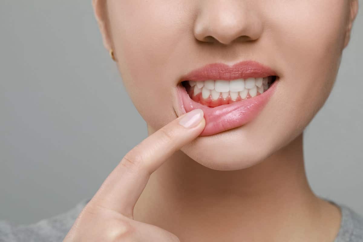 Treatments for mouth infections