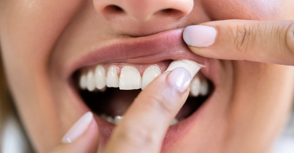 Tobacco and your teeth