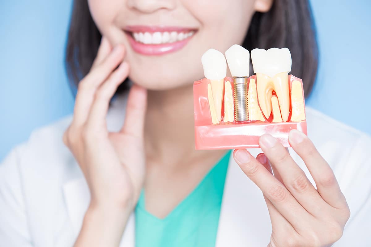 dental implants private dentist fulham