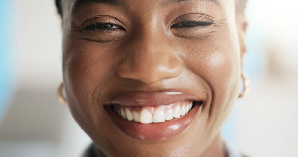 Crowns and caps for front teeth