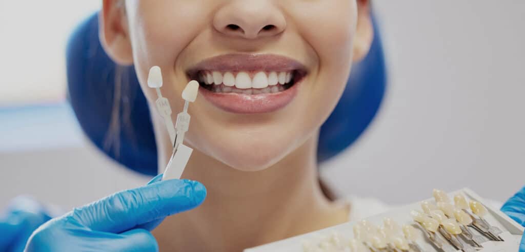 dentists composite veneers vs porcelain