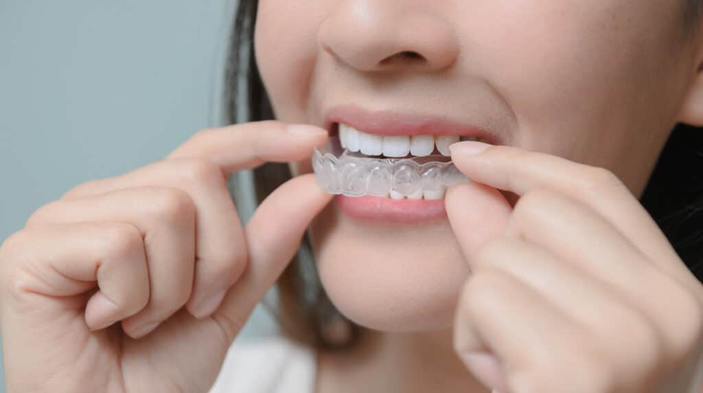 Woman with invisalign clear aligners near mouth and Invisalign treatment time