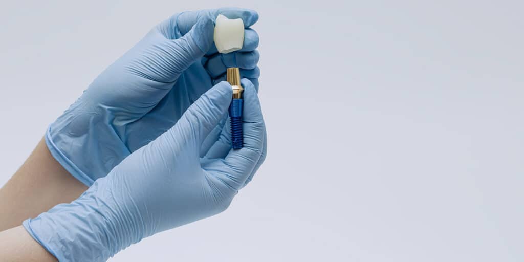 Gloved hands holding up dental implant and the cost of dental implants in london