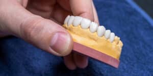 full mouth dental implants